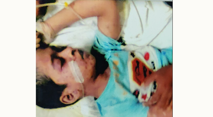 ফরিদপুরে মামা-ভাগিনার লাশ উত্তোলনের এক বছরেও তদন্ত প্রতিবেদন নয়