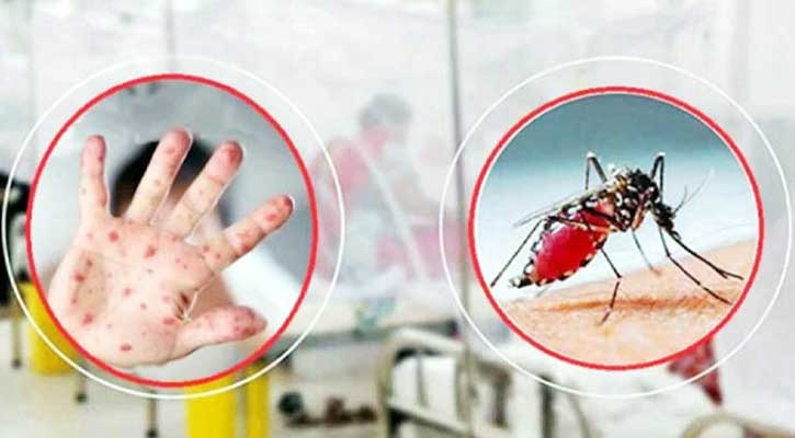 গত ২৪ ঘণ্টায় হাম ও ডেঙ্গুতে আরও ১৮ জনের মৃত্যু