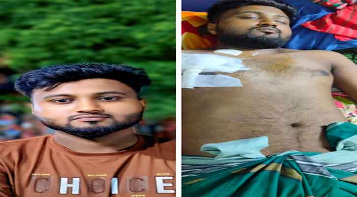 দুই কিডনি বিকল,জীবন-মৃত্যুর সন্ধিক্ষণে  কবি নজরুল কলেজের শিক্ষার্থী সুমন