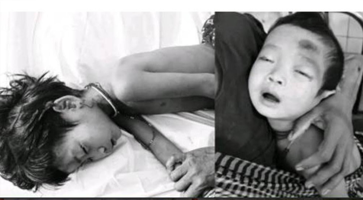 লামায় হামের থাবায় একই পরিবারের দুই ম্রো শিশুর মৃত্যু
