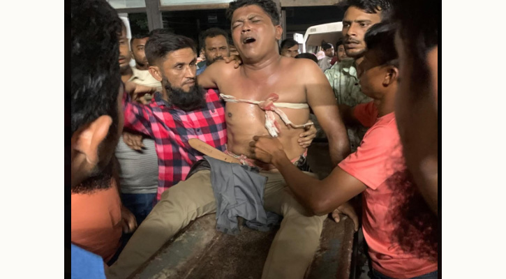 খুলনার বটিয়াঘাটায় যুবদলের সাবেক নেতাকে গুলি, হাসপাতালে প্রেরণ