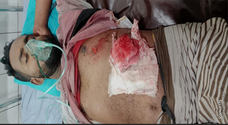 সোনারগাঁয়ে পাওনা টাকার বিরোধে ঠিকাদারকে হত্যা-