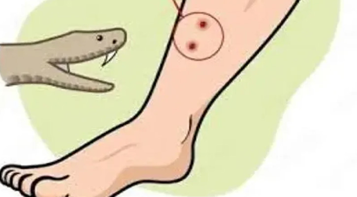 সাতক্ষীরায় সাপের কামড়ে ঘুমন্ত শিশুর মৃত্যু