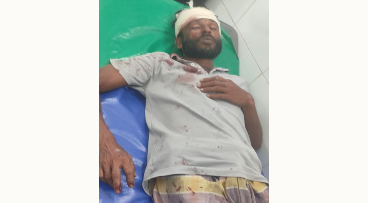 রামপালে নির্বাচনী প্রচারণা নিয়ে প্রতিহিংসা মূলক হামলা, গুরুতর আহত -৬