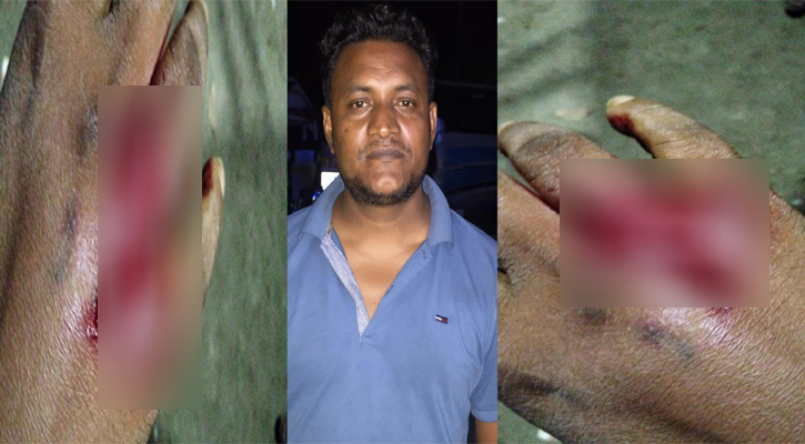 মোংলায় মাছ চুরি ঠেকাতে গিয়ে বিএনপি কর্মী কুপিয়ে জখম