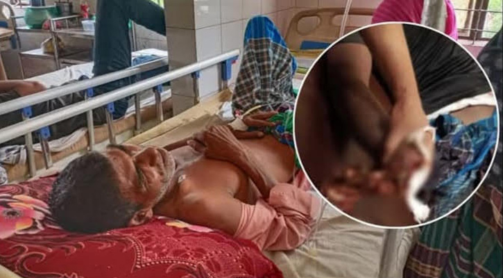 শরীয়তপুর জাজিরা আধিপত্য বিস্তারে বোমায় আহত ১৫