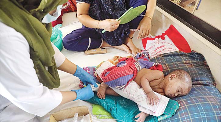 এবার সারাদেশে একযোগে শুরু হচ্ছে হামের টিকাদান কর্মসূচি