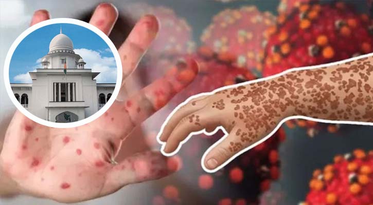 হামে মারা যাওয়া ৩৫২ শিশুর পরিবারকে ২ কোটি টাকা করে ক্ষতিপূরণ দিতে রিট