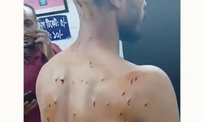 নোয়াখালীতে গায়ে হলুদে যাওয়ার পথে গুলিবিদ্ধ ৫