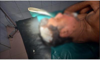 নিসচার মহাসচিব সড়ক দুর্ঘটনায় গুরুতর আহত