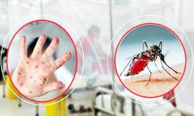 গত ২৪ ঘণ্টায় হাম ও ডেঙ্গুতে আরও ১৮ জনের মৃত্যু