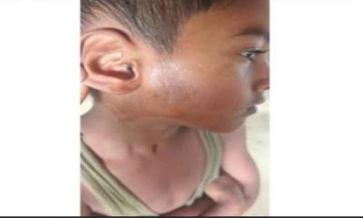 মাদ্রাসা শিক্ষকের বিরুদ্ধে শিক্ষার্থীকে মারধরের অভিযোগ, আদালতে মামলা