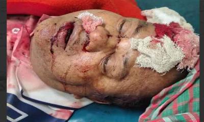 পাবনার  সড়ক দুর্ঘটনায়  নিহত ১,  আহত ১