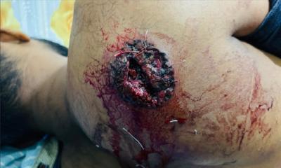 সাতক্ষীরা সীমান্তে বিএসএফের গুলিতে দুই বাংলাদেশি আহত