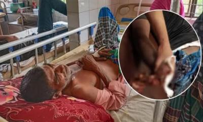 শরীয়তপুর জাজিরা আধিপত্য বিস্তারে বোমায় আহত ১৫