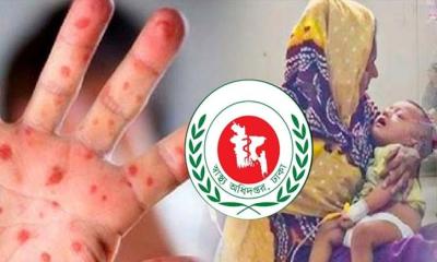 ২৪ ঘণ্টায় হাম উপসর্গে ১১ জনের মৃত্যু