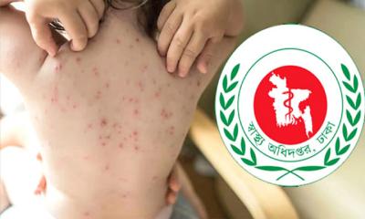 হামে আরও ১১ শিশুর মৃত্যু